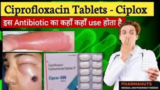 Ciprofloxacin tablet  Ciplox tablet Zoxan tablet use  side effects in Hindi medicine info [upl. by Eicyal]