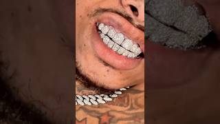 VVS LAB DIAMOND PERMANENT GRILLZ [upl. by Jourdan487]