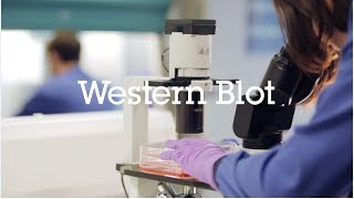 Western blot protocol video [upl. by Brandea495]