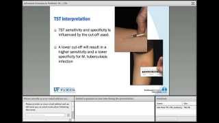 Advanced Concepts in Pediatric TB Latent TB Infection [upl. by Anoiuq218]