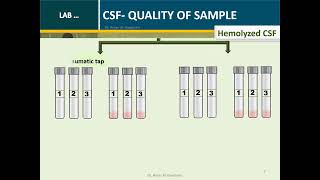 Cerebrospinal fluid Routine Analysis ChemistrySerology Tube 1 [upl. by Schonthal]