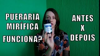 Testei Pueraria Mirifica Aumento dos Seios  Antes e Depois [upl. by Roddy868]