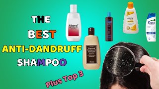 The Best Shampoos To Use For Dandruff  Scalp Dermatitis  Dry amp Itchy Scalp Treatment [upl. by Eillib]