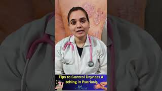 How to control Dryness and Itching in Psoriasis psoriasis psoriasiscure psoriasiswarrior skin [upl. by Greenwald]