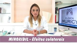 Efeitos colaterais do Minoxidil [upl. by Ahseral689]