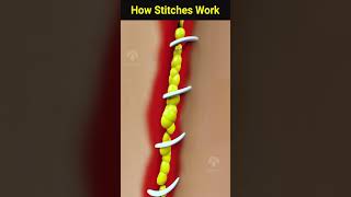 How wound stitches really work shorts facts  Creativelearning3d [upl. by Claudell]