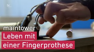 Wie Fingerprothesen das Leben leichter machen  maintower [upl. by Bonny593]