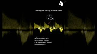 Echocardiography board practice question 08 [upl. by Fredric]