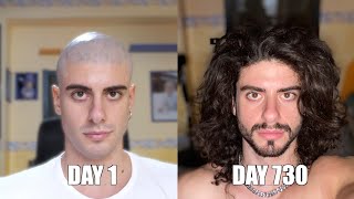 Two years time lapse of hair growth [upl. by Neslund177]