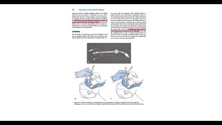 Emergency care chap 3  Airway management part 2 [upl. by Mettah]