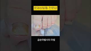 못난이 발톱 변신하기 지축네일 nail 발톱스케일링 [upl. by Asserak339]