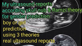 Gender prediction using ultrasound reports with help of Nub Ramzi amp skull theory [upl. by Eihpos900]