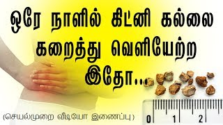 இத கொஞ்சம் முயற்சி செய்து பாருங்க How to pass a kidney stone in 24 hours in tamil  Tamil Nalam [upl. by Radcliffe77]