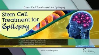 Epilepsy Treatment  Stem Cell Therapy for Epilepsy [upl. by Anatollo]