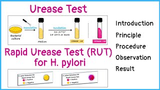 Urease test for identification of bacteria  Rapid urease test for H pylori  Principle  Procedure [upl. by Pace]