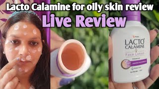 Lacto Calamine for oily skin review  Lacto Calamine Lotion  Is Lacto Calamine good for oily skin [upl. by Alekehs]