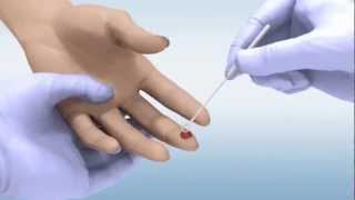 DPP® HIV 12 Assay  Whole Blood Sample [upl. by Heintz]