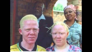 Albinism [upl. by Kendre]