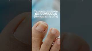 Los mejores productos para los hongos en tus pies Clearzal de Mundo Podología [upl. by Ardnosac]