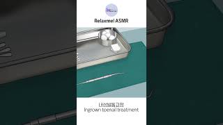 ASMR 내성 발톱 교정 ingrown toenail treatment [upl. by Trepur]