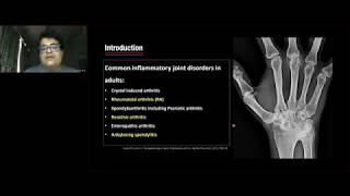 GE Webinar Ultrasound Imaging in inflammatory Arthropathies  Dr Ankit Shah [upl. by Radcliffe]