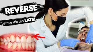 How To Treat Gum Disease [upl. by Bautram]