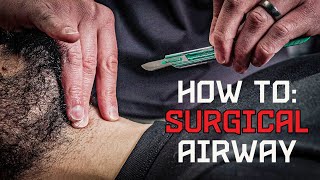 How to Emergency Surgical Cricothyrotomy [upl. by Jarred]