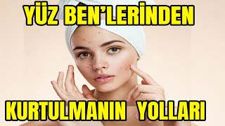 YÜZ BENLERİ NEYİN HABERCİSİ NASIL KURTULURUM DOĞAL TEDAVİSİ [upl. by Mariette]