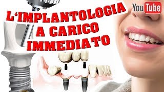 Implantologia A Carico Immediato [upl. by Yetnruoc]