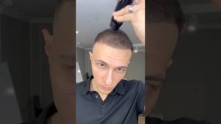 THICK FIBER  Hair Fibres for thin Hair  Hair transplant to Hair Fibers [upl. by Armyn655]