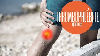 Comment traiter les thrombophlébites et caillots des veines par radiologie interventionnelle [upl. by Licna]