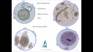 Balantidium coli Ciliate [upl. by Coveney176]