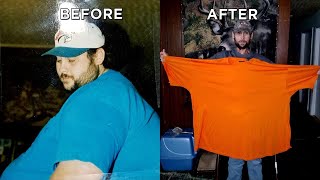 See Man’s Incredible Skin Removal Surgery After Losing 550 Pounds [upl. by Xenia]