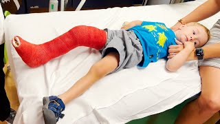 MY 3 YEAR OLDS BROKEN LEG ADVENTURE [upl. by Noirod]