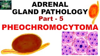 Adrenal Gland Pathology Part 5 PHEOCHROMOCYTOMA  Genetics  clinical features  Pathology [upl. by Whiting470]