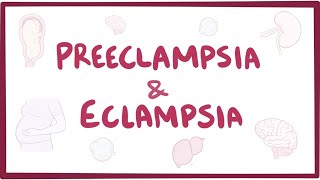 Preeclampsia amp eclampsia  causes symptoms diagnosis treatment pathology [upl. by Senaj]