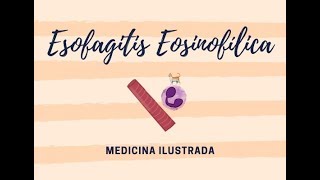 Esofagitis Eosinofílica [upl. by Dott]