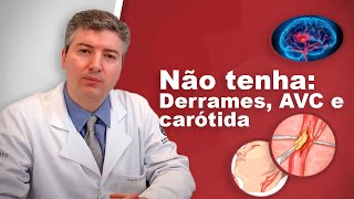 Derrames e a artéria carótida Dr Alexandre Amato [upl. by Matronna798]