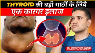 Effective Treatment For Multinodular Goitre  Thyroid Artery Embolisation  Dr Gaurav GangwaniIR [upl. by Evets]