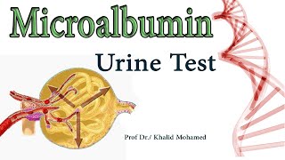 Microalbumin MA Urine Albumin Albumin to Creatinine Ratio [upl. by Ahsie476]