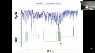 EPISODIOS DE HIPOXEMIA EN EL PREMATURO [upl. by Monto847]