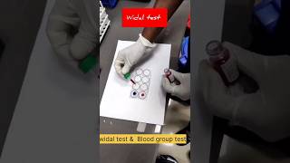 widal test and blood group test nursing students [upl. by Bora316]