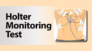 Holter Monitoring Test [upl. by Mihalco]