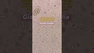 Giardia lamblia under the microscope laboratory microscope mls cls medtechstudent [upl. by Hairaza]