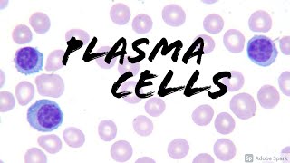 Plasma Cells on Peripheral Blood Smear Hemepath Hematology Pathology [upl. by Noterb114]