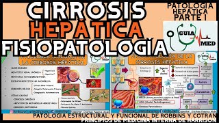 CIRROSIS HEPÁTICA FISIOPATOLOGÍA  GuiaMed [upl. by Vada805]