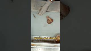 Uterus specimen cutting 🧐✂️ [upl. by Eetsud]