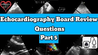 Echocardiography Registry Review [upl. by Cerveny]