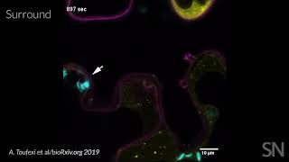 Watch lightharvesting chloroplasts fight off a plant infection  Science News [upl. by Fen]