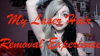 My bad Laser Hair Removal Experience [upl. by Selma]